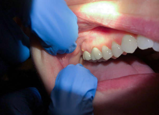 Best Emergency Cosmetic Dentistry (e.g., broken veneers) in Parkway, CA