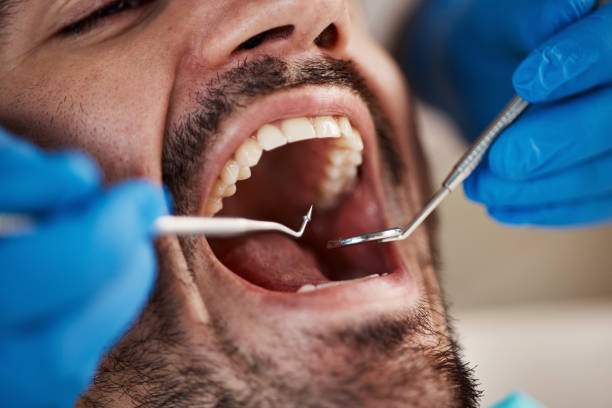 Best Broken or Chipped Tooth Repair in Parkway, CA